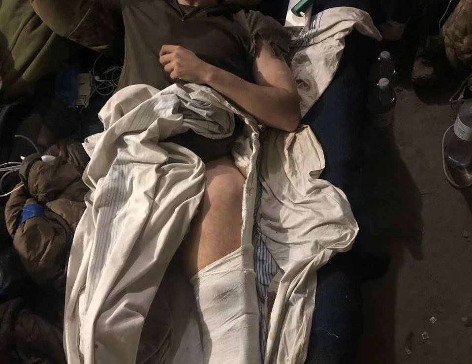 Олександр у шпиталі на "Азовсталі"