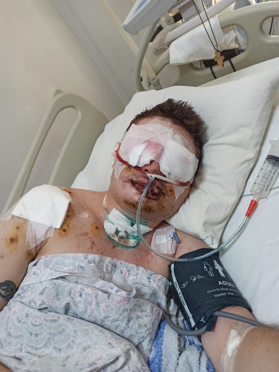Перші дні після поранення стан Віталія був дуже тяжким