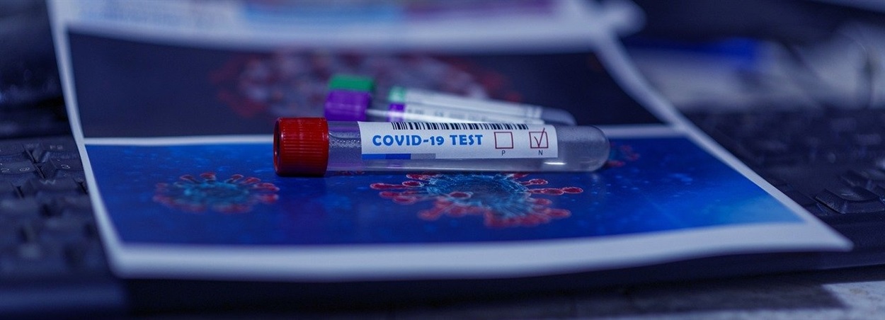 Тест на коронавирус COVID-19