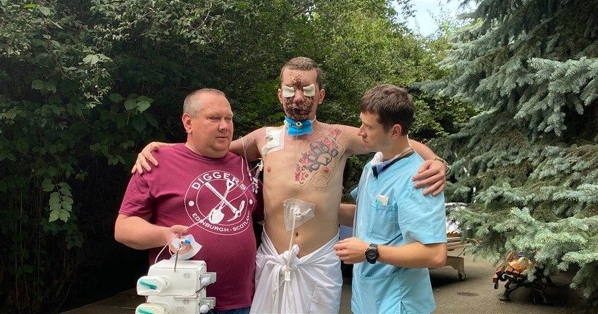 Демінер Владислав Єщенко втратив зір та слух на фронті