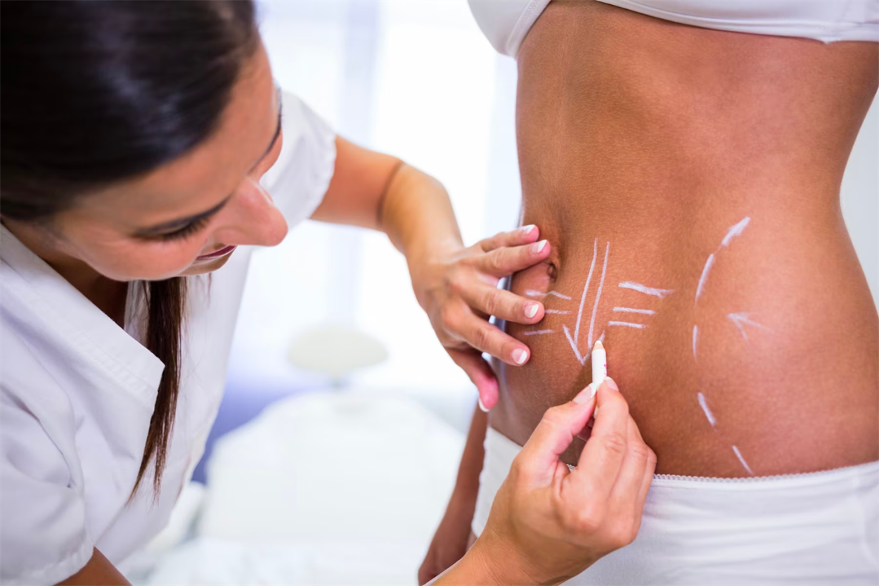 https://platinumlaser.com.ua/plastyka-tila/liposakcziya