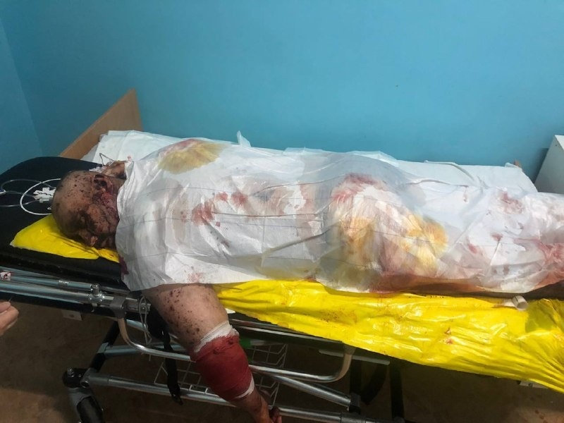 Спочатку Ігоря доставили до місцевої лікарні 