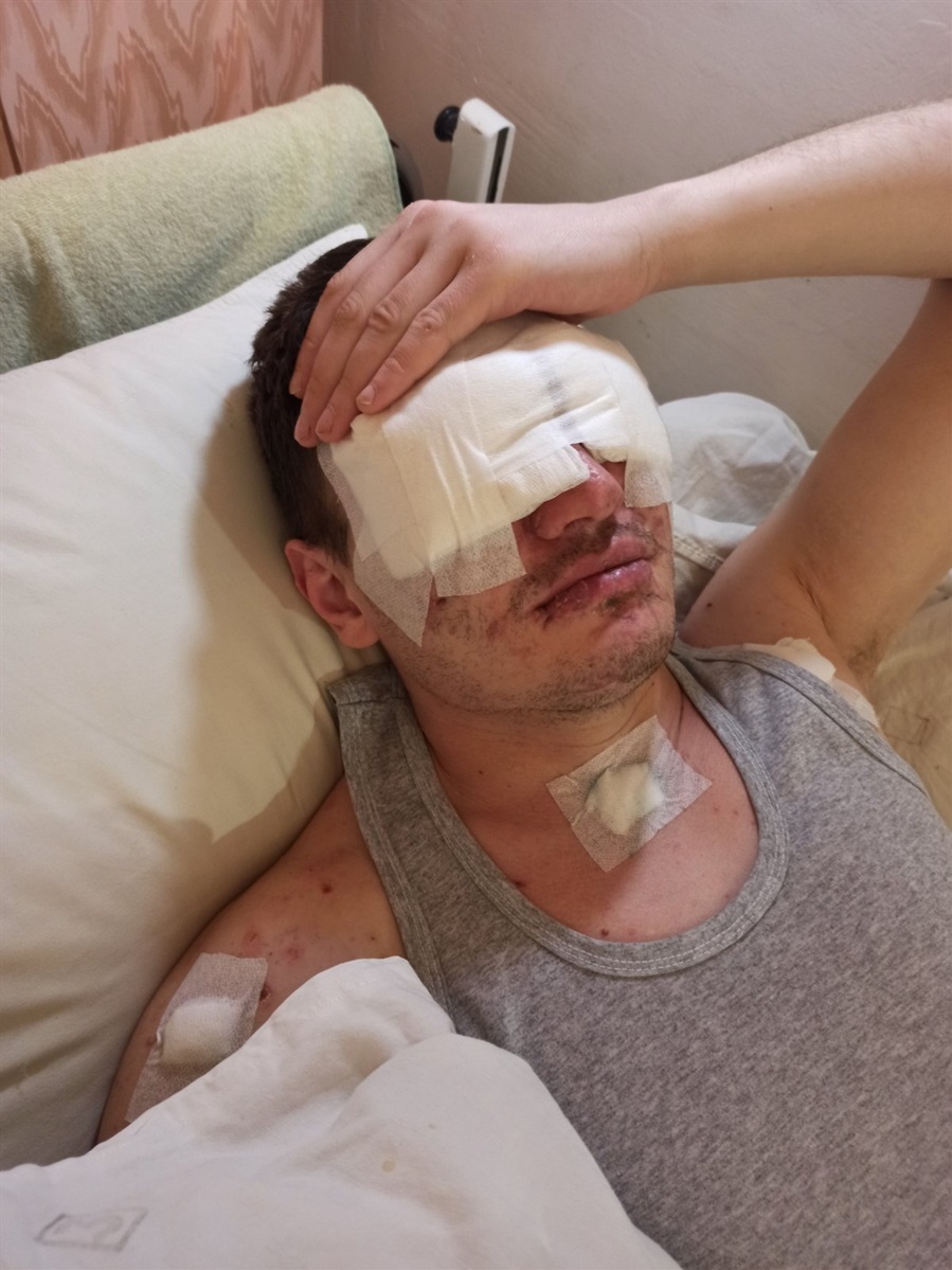 Без допомоги рідних самому з такими пораненнями складно навіть у лікарні